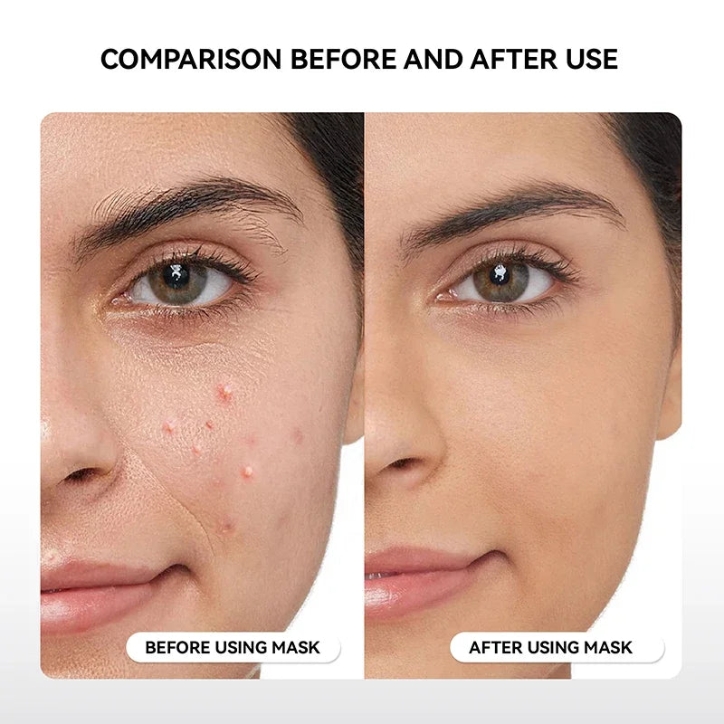 Hello Face Wireless Near-Infrared Light and Red Light Therapy Face Mask For Powerful Anti-ageing Professional Ultra-light Mask