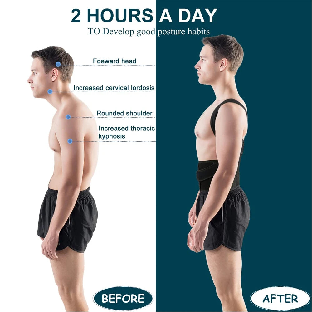 Back Brace Posture Corrector for both women and men is an adjustable posture trainer designed for straightening the back and correcting scoliosis and hunchback.